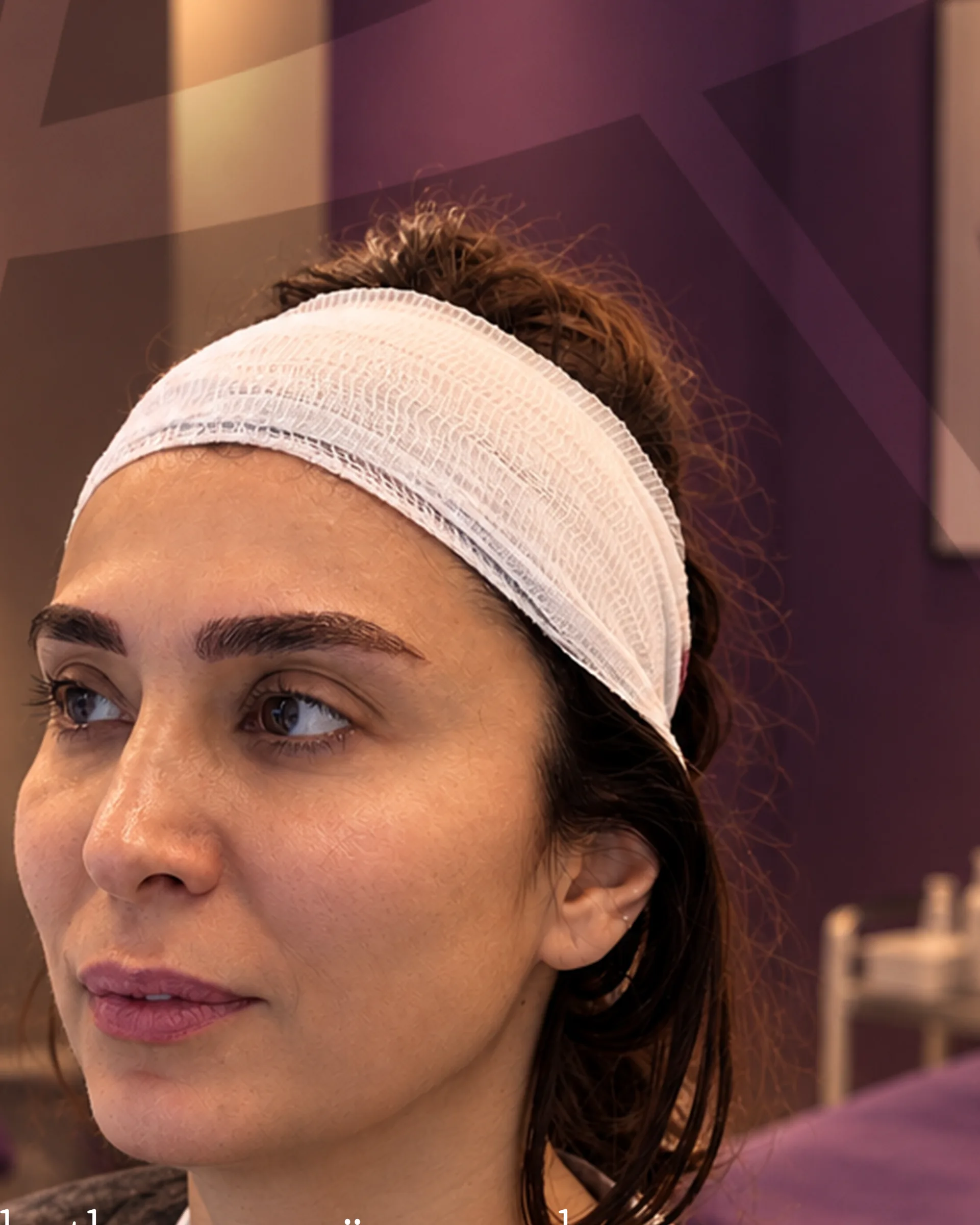 Beyaz bandajlı bir hasta işlem odasında oturuyor, yandan görünüm.