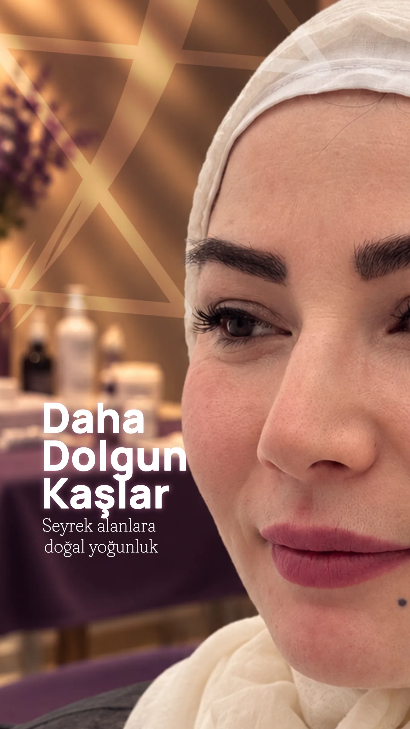 Bir hastanın işlem sonrası yakın portresi; üzerinde “Daha Dolgun Kaşlar — seyrek alanlara doğal yoğunluk” yazıyor.