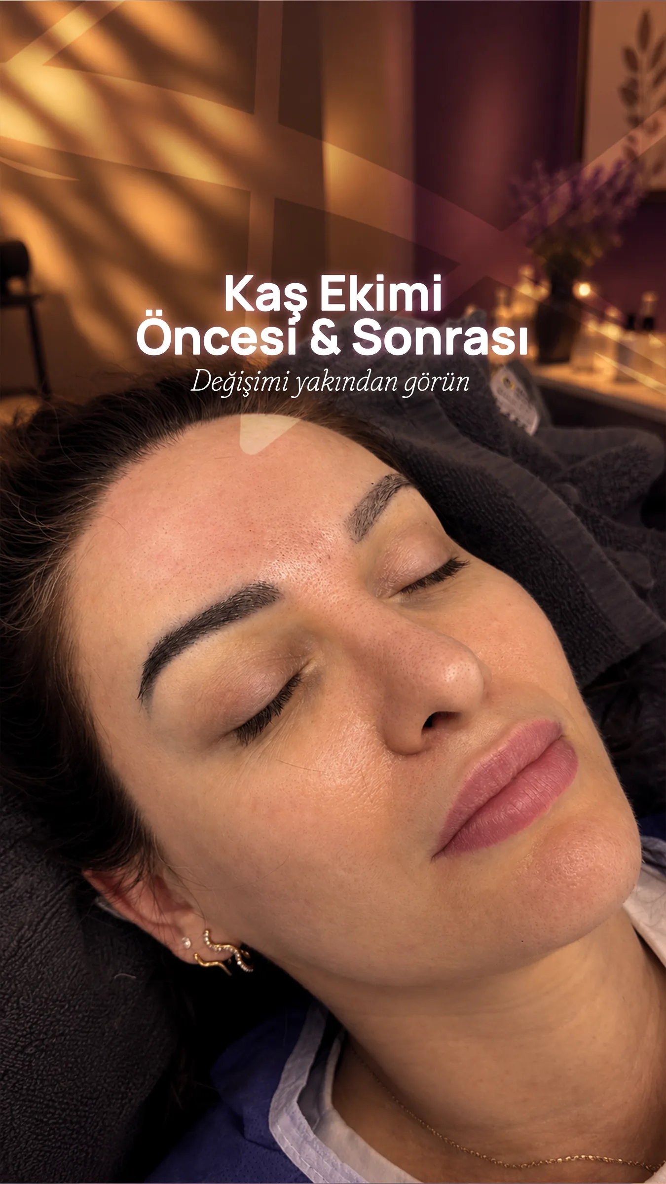 İşlem sonrası gözleri kapalı bir hasta; üzerinde “Kaş Ekimi Öncesi & Sonrası — değişimi yakından görün” yazıyor.